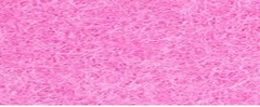 YAMSIS-27 Peach Blossom Pink