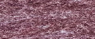 YAMSIS-44 Mystery Purple